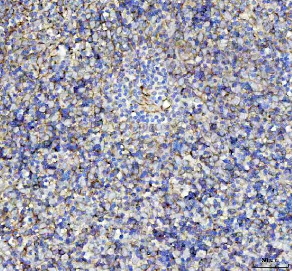 2 - Anti-LOX Rabbit Monoclonal Antibody ABO13289