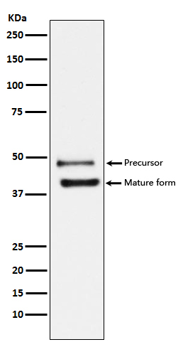 1 - Anti-DR5 Rabbit Monoclonal Antibody ABO13290