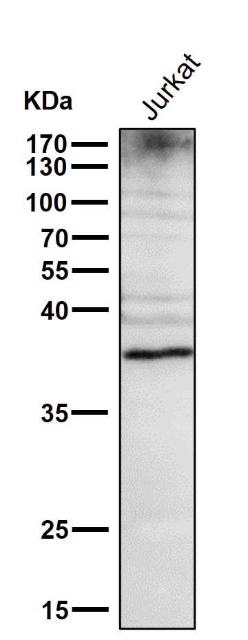 1 - Anti-DR5 Rabbit Monoclonal Antibody ABO13290