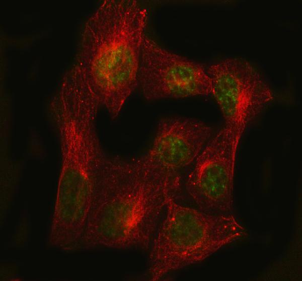 3 - Anti-PCNA Rabbit Monoclonal Antibody ABO13291