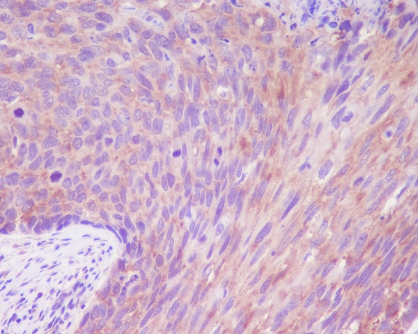 2 - Anti-DSG1/Desmoglein 1 Rabbit Monoclonal Antibody ABO13292