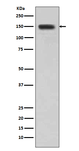 1 - Anti-DSG1/Desmoglein 1 Rabbit Monoclonal Antibody ABO13292