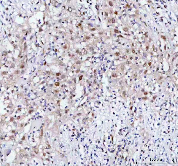 2 - Anti-PRC1 Rabbit Monoclonal Antibody ABO13293