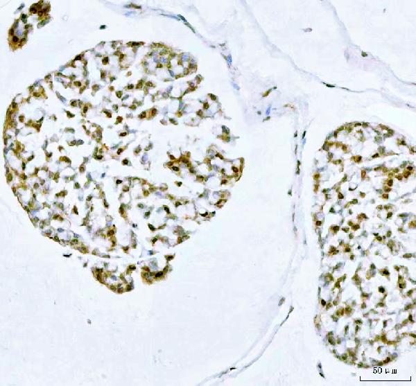 2 - Anti-PRC1 Rabbit Monoclonal Antibody ABO13293