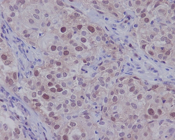 2 - Anti-CDK2 Rabbit Monoclonal Antibody ABO13294