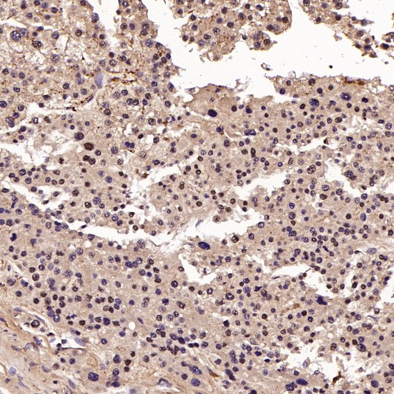 2 - Anti-CDK2 Rabbit Monoclonal Antibody ABO13294