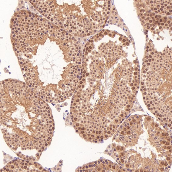 2 - Anti-CDK2 Rabbit Monoclonal Antibody ABO13294