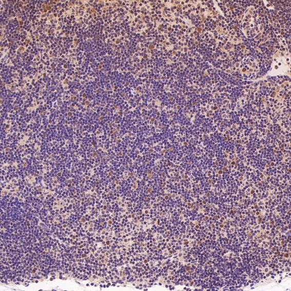 2 - Anti-CDK2 Rabbit Monoclonal Antibody ABO13294