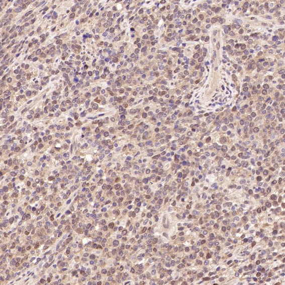 2 - Anti-CDK2 Rabbit Monoclonal Antibody ABO13294