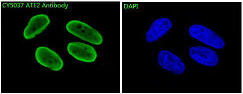 3 - Anti-ATF2 Rabbit Monoclonal Antibody ABO13295