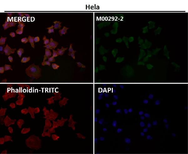 1 - Anti-MEK1 MAP2K1 Rabbit Monoclonal Antibody ABO13296