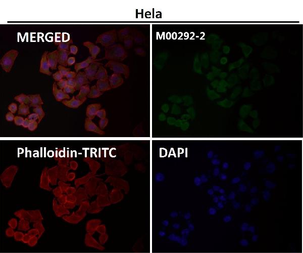 1 - Anti-MEK1 MAP2K1 Rabbit Monoclonal Antibody ABO13296