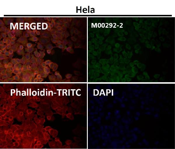 1 - Anti-MEK1 MAP2K1 Rabbit Monoclonal Antibody ABO13296
