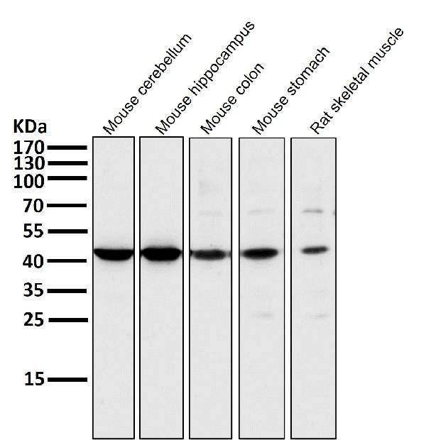 1 - Anti-MEK1 MAP2K1 Rabbit Monoclonal Antibody ABO13296