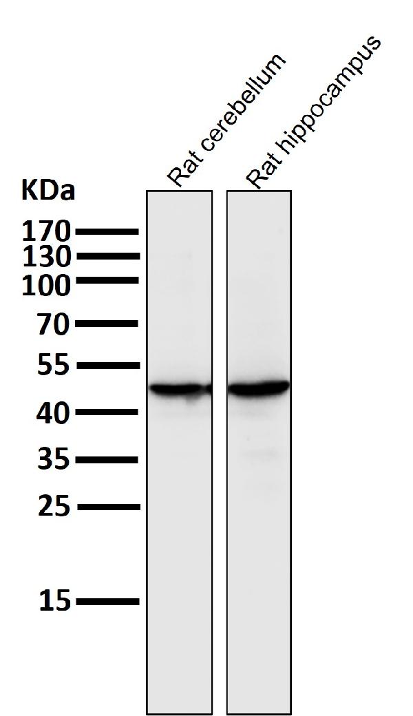 1 - Anti-MEK1 MAP2K1 Rabbit Monoclonal Antibody ABO13296