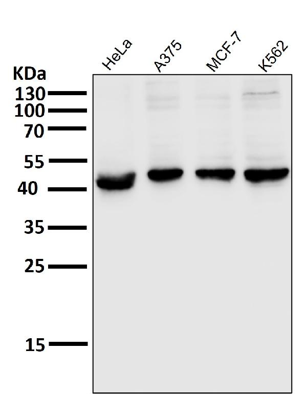 1 - Anti-MEK1 MAP2K1 Rabbit Monoclonal Antibody ABO13296