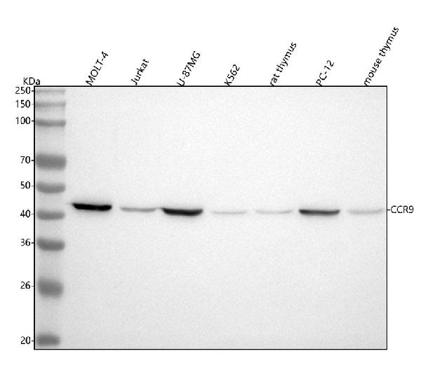 1 - Anti-CCR9 Rabbit Monoclonal Antibody ABO13297