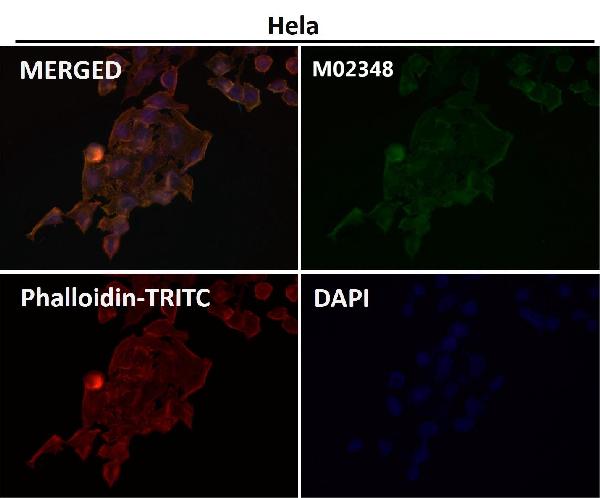 1 - Anti-CCR9 Rabbit Monoclonal Antibody ABO13297