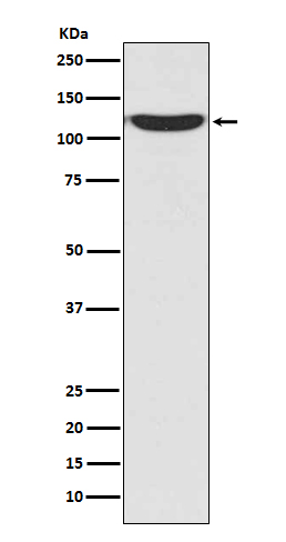 1 - Anti-PKN2/Prk2 Rabbit Monoclonal Antibody ABO13300