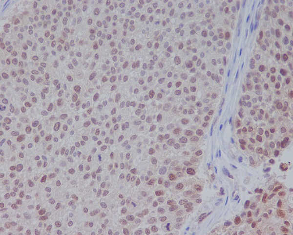 2 - Anti-ERK1 MAPK3 Rabbit Monoclonal Antibody ABO13301
