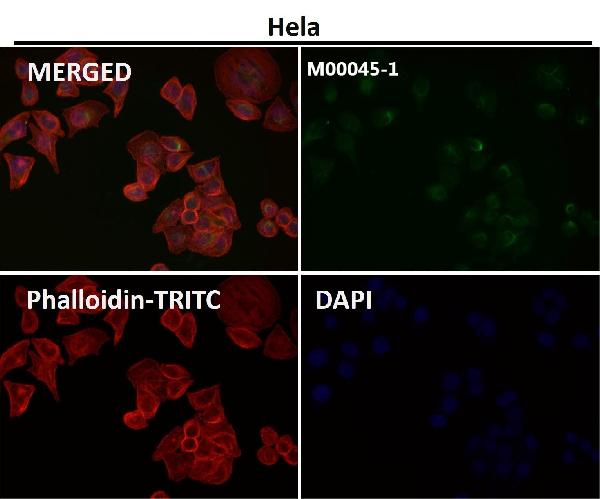 1 - Anti-VEGF VEGFA Rabbit Monoclonal Antibody ABO13302