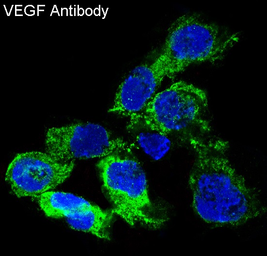 3 - Anti-VEGF VEGFA Rabbit Monoclonal Antibody ABO13302