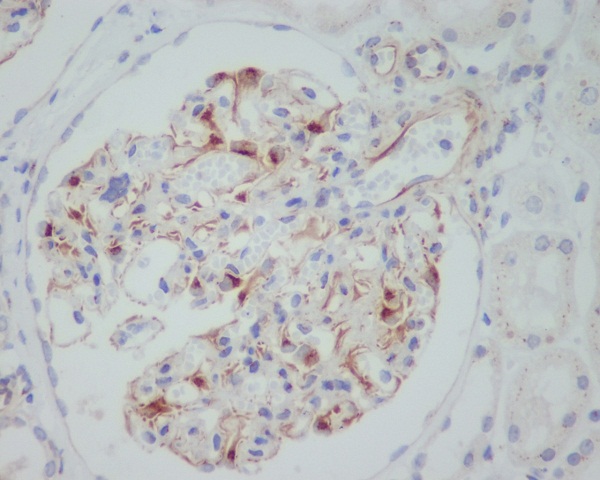 2 - Anti-VEGF VEGFA Rabbit Monoclonal Antibody ABO13302