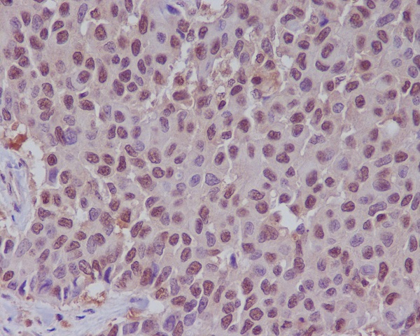 2 - Anti-ERK1 MAPK3 Rabbit Monoclonal Antibody ABO13303