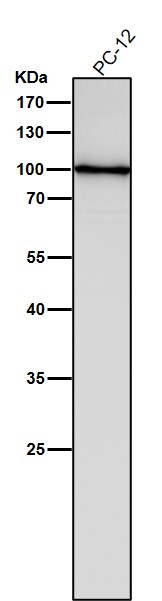 1 - Anti-TLR2 Rabbit Monoclonal Antibody ABO13305