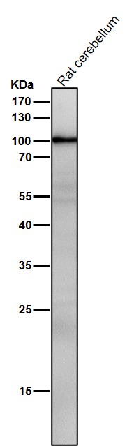 1 - Anti-TLR2 Rabbit Monoclonal Antibody ABO13305