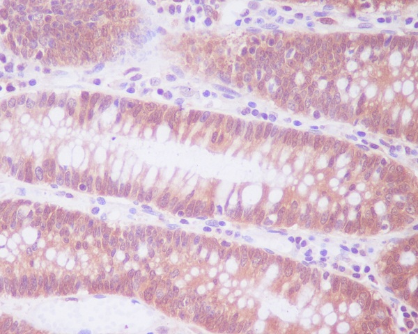 2 - Anti-ENO1/Alpha Enolase Rabbit Monoclonal Antibody ABO13306