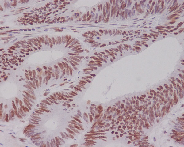 2 - Anti-MSH6/Gtbp Rabbit Monoclonal Antibody ABO13307