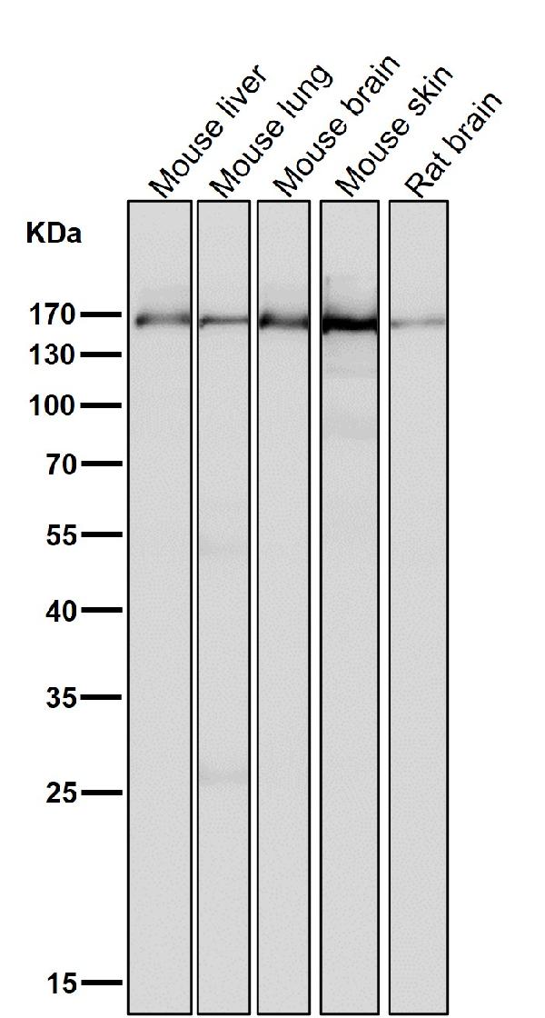 1 - Anti-MSH6/Gtbp Rabbit Monoclonal Antibody ABO13307