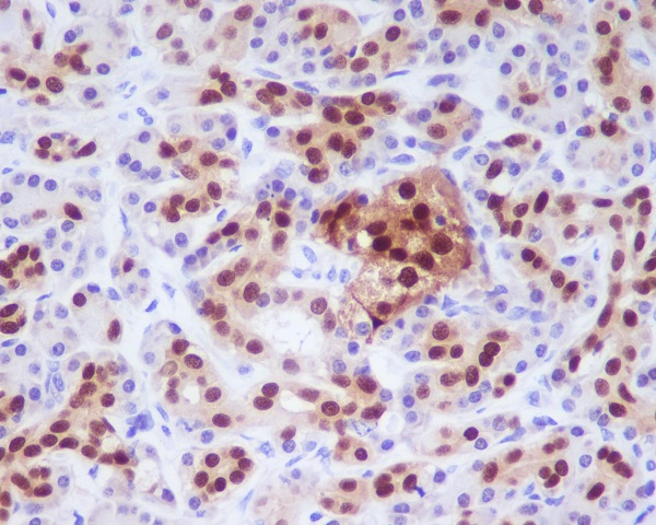 2 - Anti-PDX1/Ipf1 Rabbit Monoclonal Antibody ABO13308