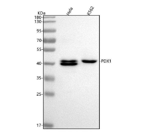 1 - Anti-PDX1/Ipf1 Rabbit Monoclonal Antibody ABO13308