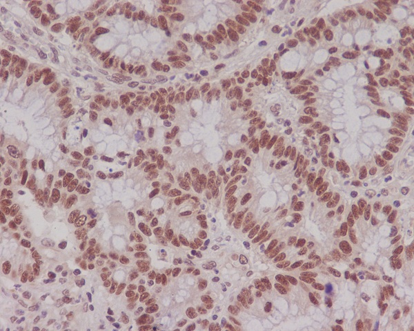 2 - Anti-MLH1 Rabbit Monoclonal Antibody ABO13309
