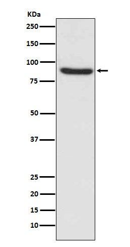 1 - Anti-MLH1 Rabbit Monoclonal Antibody ABO13309