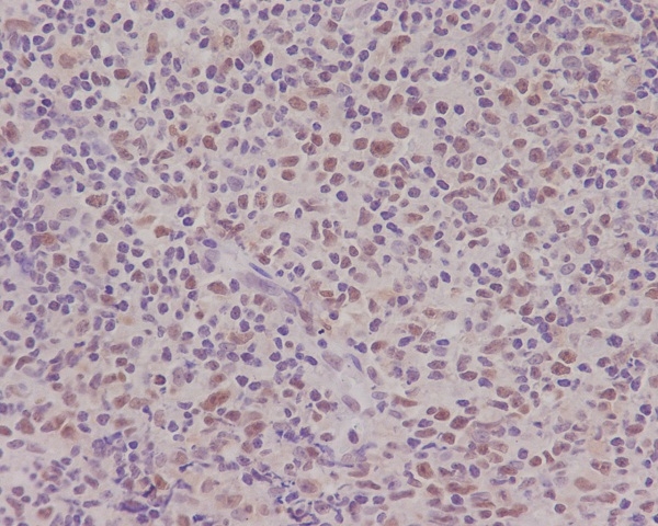 2 - Anti-PMS2 Rabbit Monoclonal Antibody ABO13310