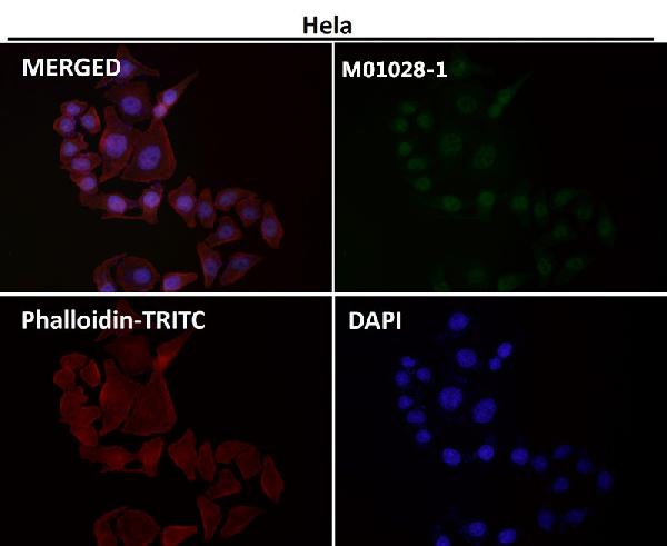 1 - Anti-PMS2 Rabbit Monoclonal Antibody ABO13310