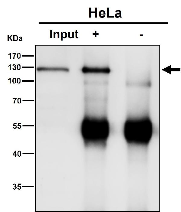 1 - Anti-PMS2 Rabbit Monoclonal Antibody ABO13310