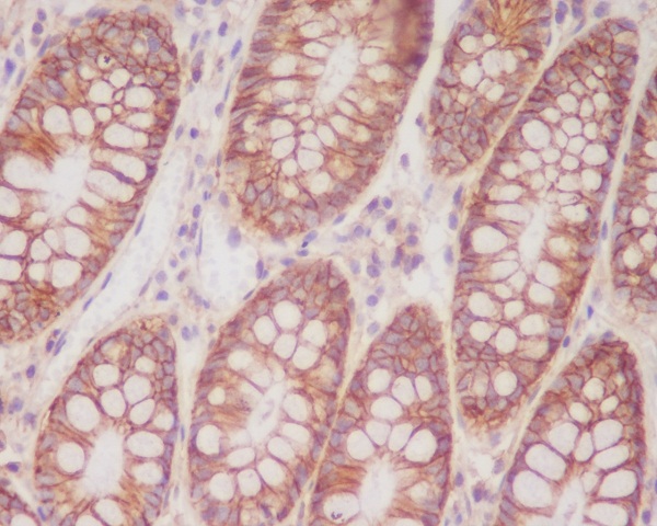 2 - Anti-CD46 Rabbit Monoclonal Antibody ABO13311