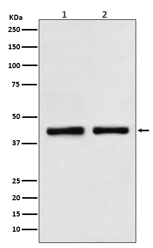 1 - Anti-SNF5 SMARCB1 Rabbit Monoclonal Antibody ABO13312