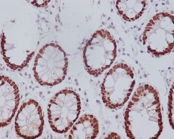 2 - Anti-CDX2 Rabbit Monoclonal Antibody ABO13313