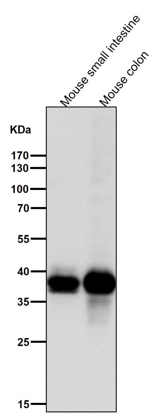 1 - Anti-CDX2 Rabbit Monoclonal Antibody ABO13313