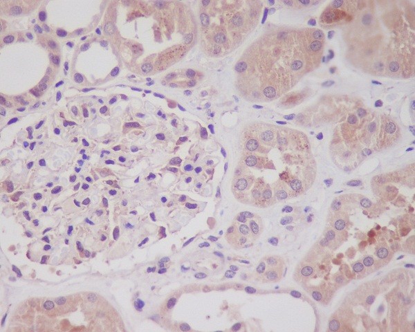 2 - Anti-Nrf2 NFE2L2 Rabbit Monoclonal Antibody ABO13314