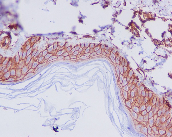 2 - Anti-CD44 Rabbit Monoclonal Antibody ABO13315