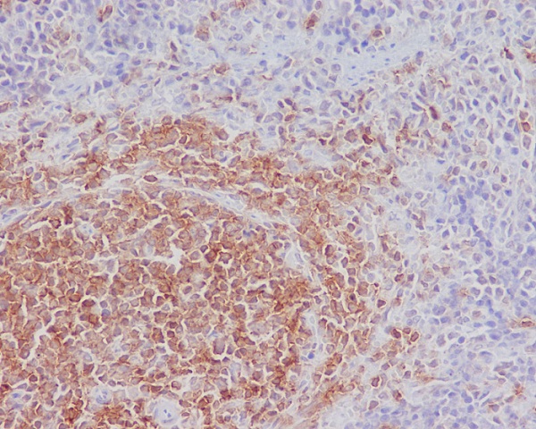 2 - Anti-SHIP INPP5D Rabbit Monoclonal Antibody ABO13316