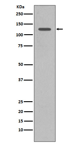 1 - Anti-SHIP INPP5D Rabbit Monoclonal Antibody ABO13316