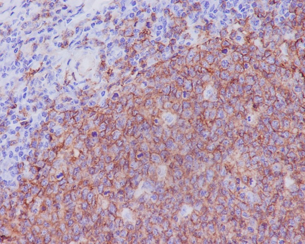 2 - Anti-CD20 MS4A1 Rabbit Monoclonal Antibody ABO13318
