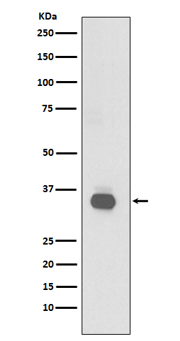 1 - Anti-CD20 MS4A1 Rabbit Monoclonal Antibody ABO13318